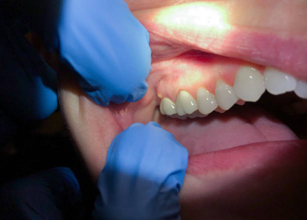 Best Emergency Dental Surgery in California, MD